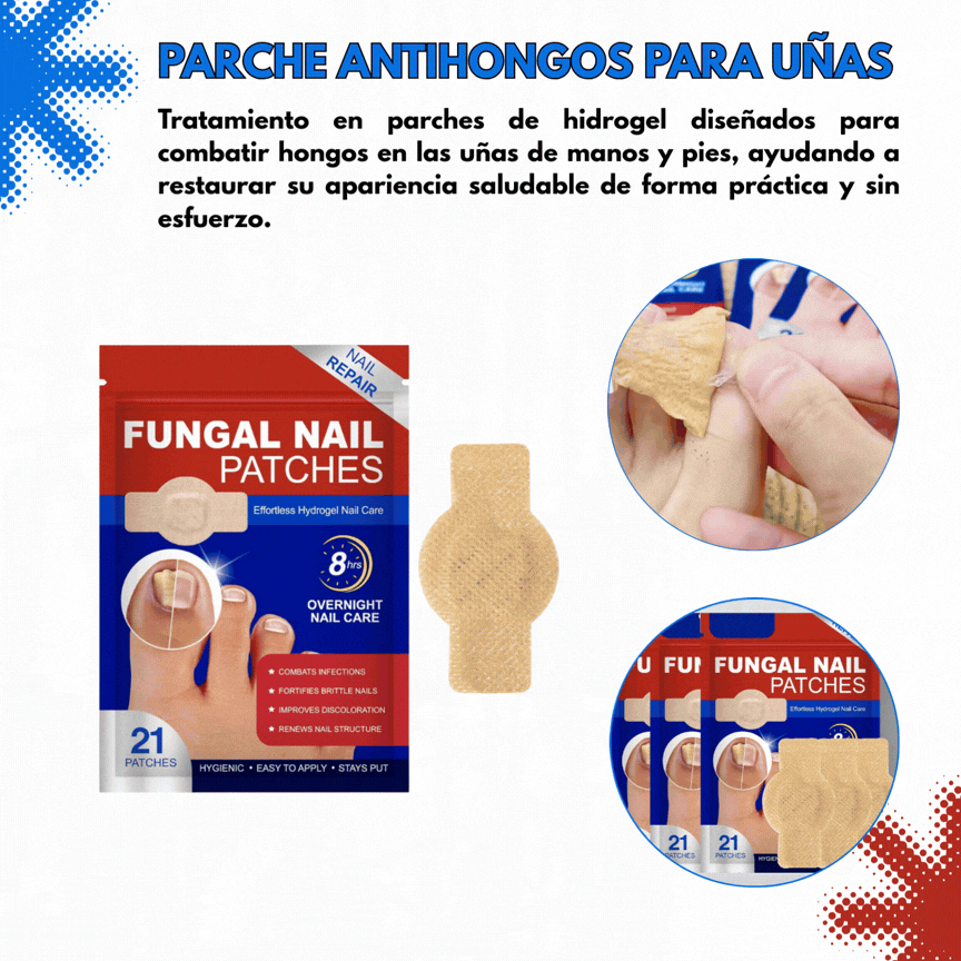 PARCHES ANTIHONGOS PARA UÑAS